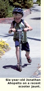 scooter