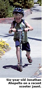 scooter